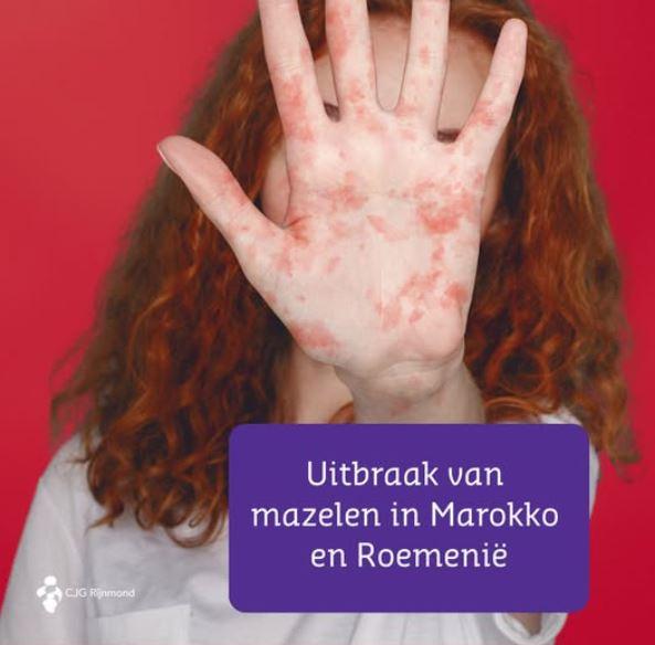 Mazelen in de regio Rotterdam-Rijnmond